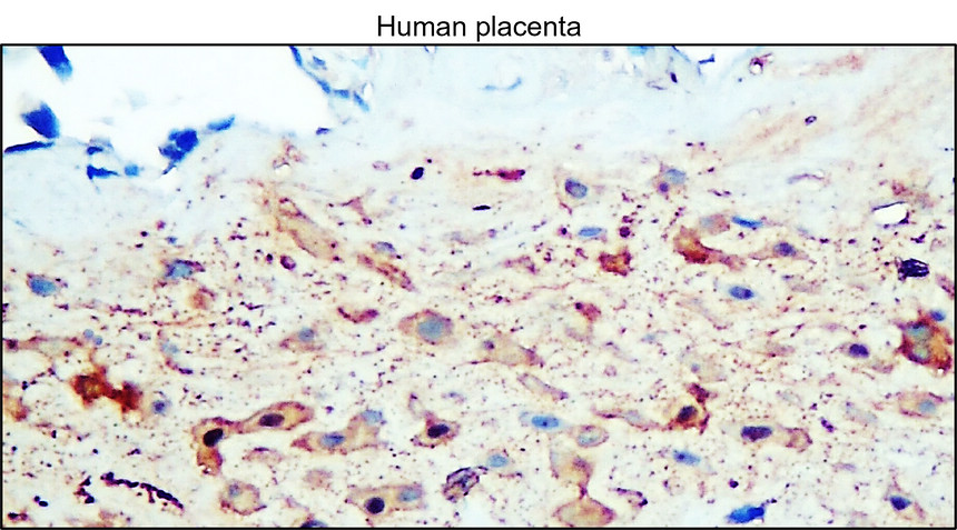 IR31-90 anti- NSE / Enolase-2 antibody IHC image