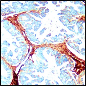 Collagen I antibody Collagen I antibody