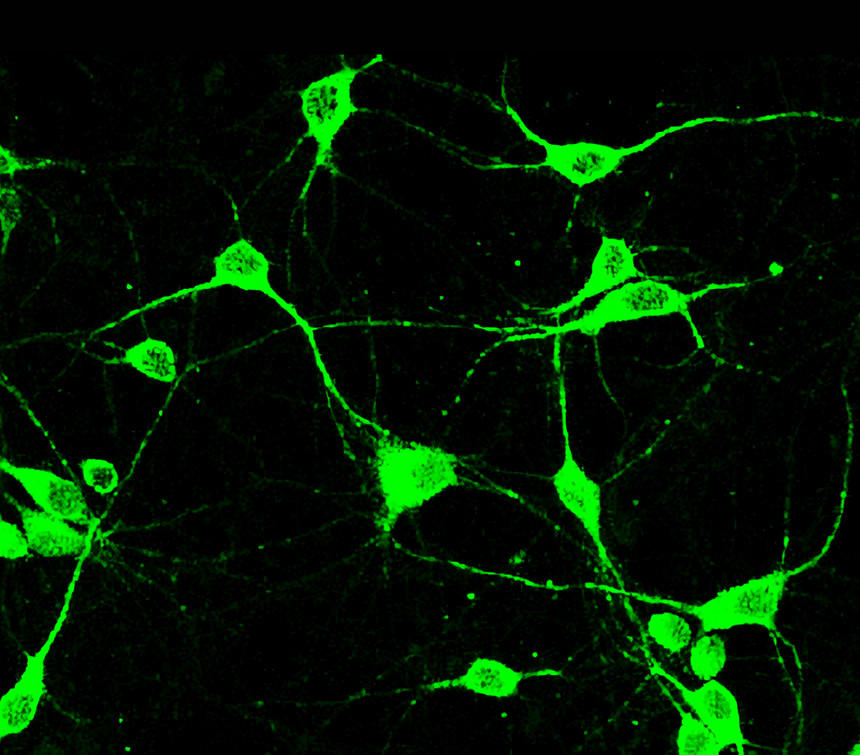 IRM043 GFP, monoclonal antibody ICC/IF image IRM043 GFP, monoclonal antibody ICC/IF image