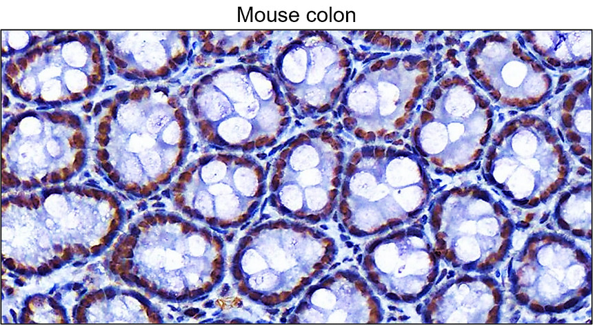 IRM045 phospho Histone H2A.X (Ser139), monoclonal antibody IHC image