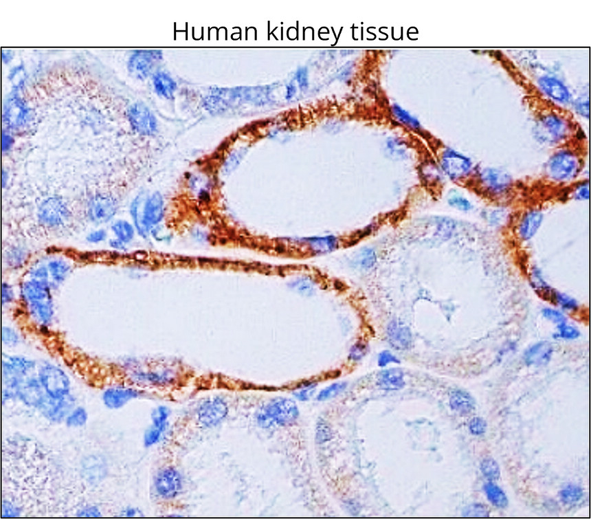 IRM046 TSG101, monoclonal antibody IHC image IRM046 TSG101, monoclonal antibody IHC image