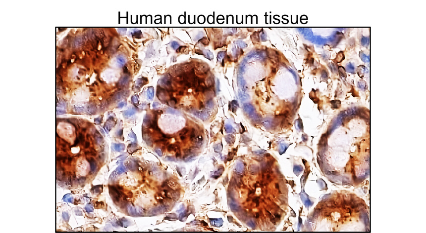 IRM049 Phospho p38 MAPK (Thr180Tyr182), monoclonal antibody IHC image