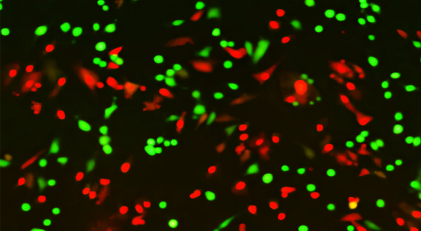 Microscope image of Live/Dead assay of neural cells.