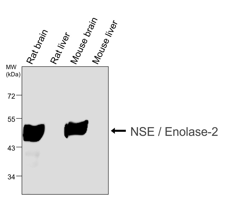 IR31M53 anti-NSE / Enolase-2 monoclonal antibody [12F] WB image