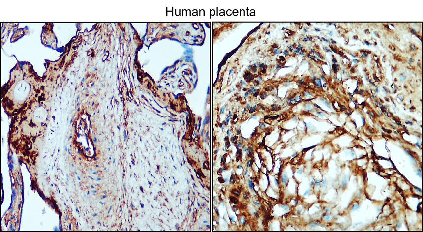 IR296-1 anti-Collagen II / COL2A1 antibody IHC image