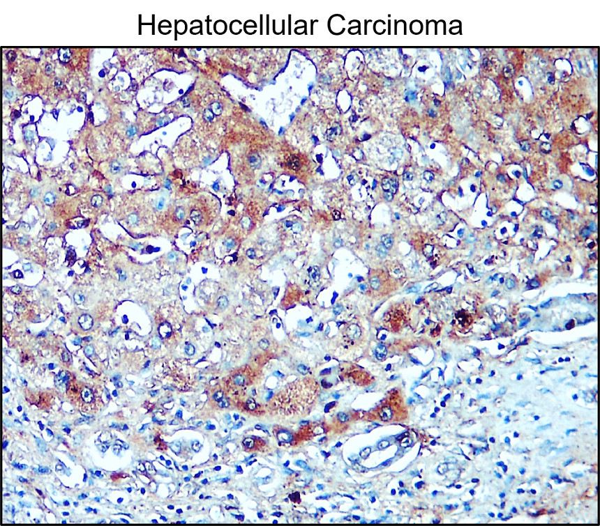 IR296-1 anti-Collagen II / COL2A1 antibody IHC image