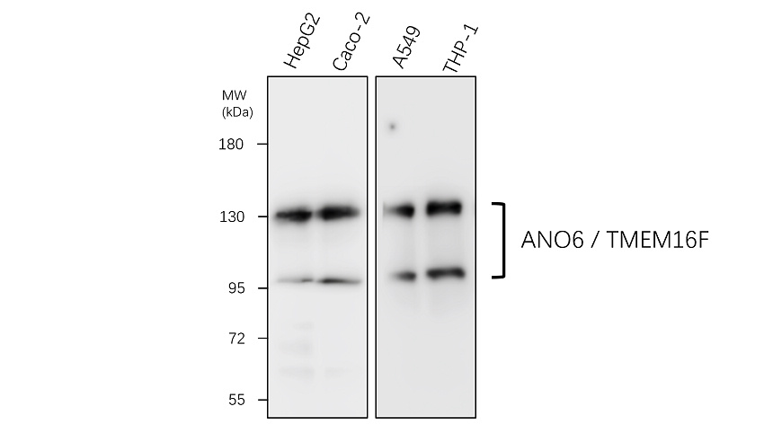 IR390-1 anti-ANO6 / TMEM16F antibody WB image IR390-1 anti-ANO6 / TMEM16F antibody WB image