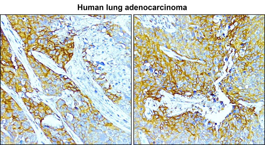 IRY25001 Carbonic Anhydrase IX / CA-IX IgY IHC image