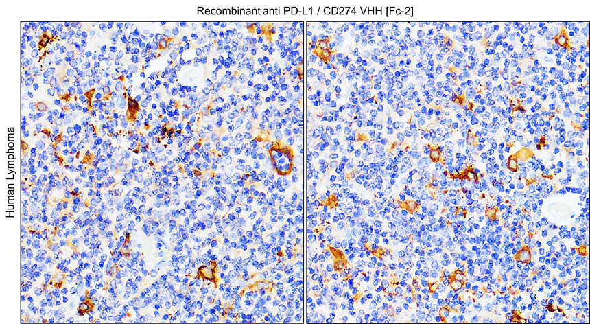 Recombinant anti PD-L1 / CD274 VHH [Fc-2] IHC image